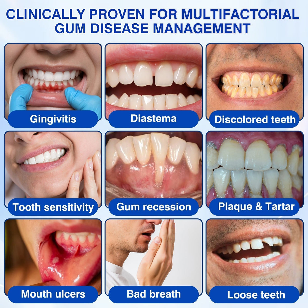 🇺🇸🏅🦷🛡️NuvessaSkin® GumRevive Periodontal Repair Gel