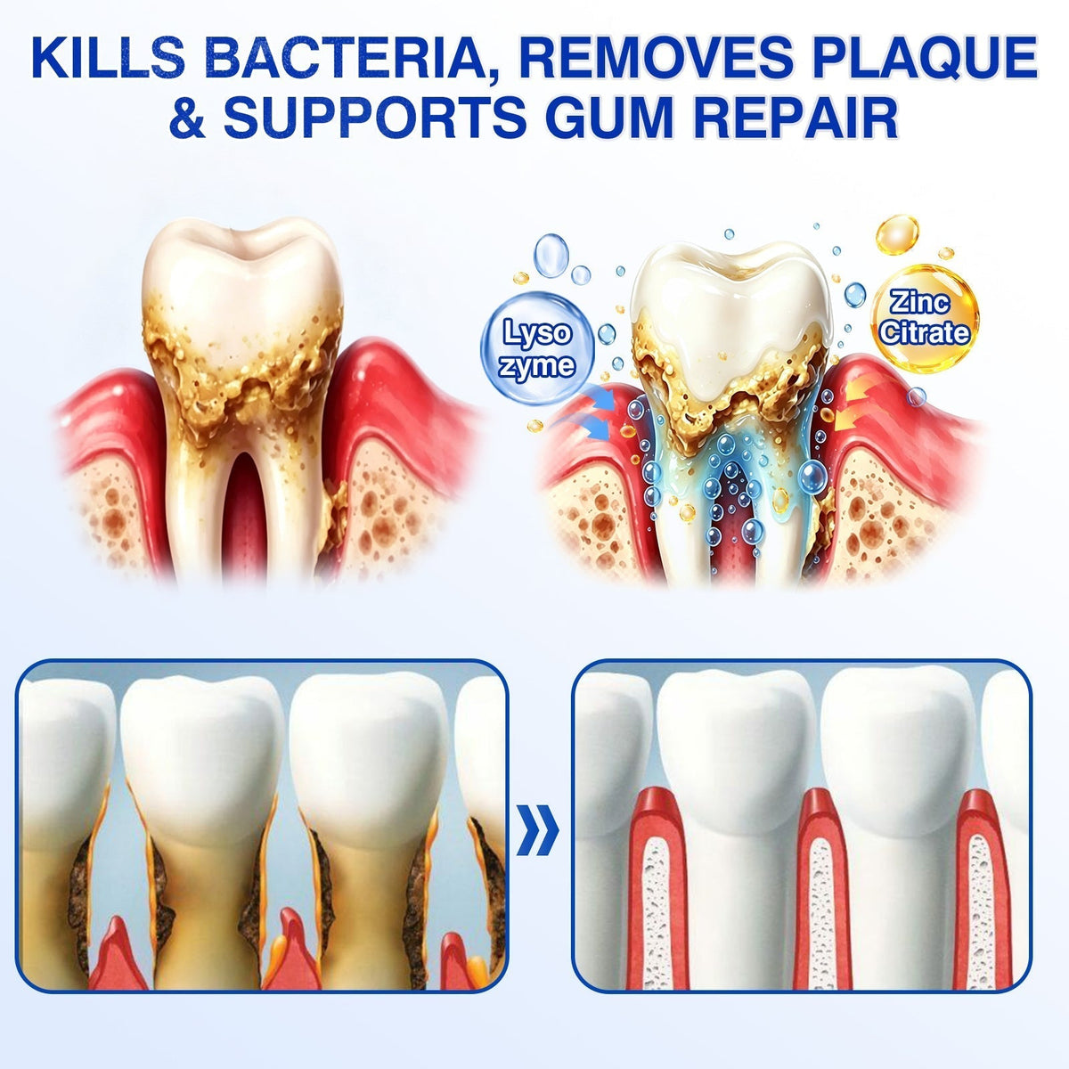🇺🇸🏅🦷🛡️NuvessaSkin® GumRevive Periodontal Repair Gel