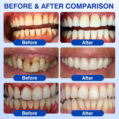 🇺🇸🏅🦷🛡️NuvessaSkin® GumRevive Periodontal Repair Gel
