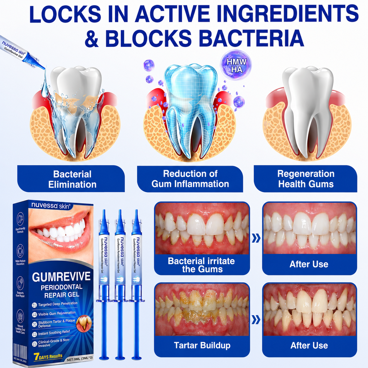 🇺🇸🏅🦷🛡️NuvessaSkin® GumRevive Periodontal Repair Gel
